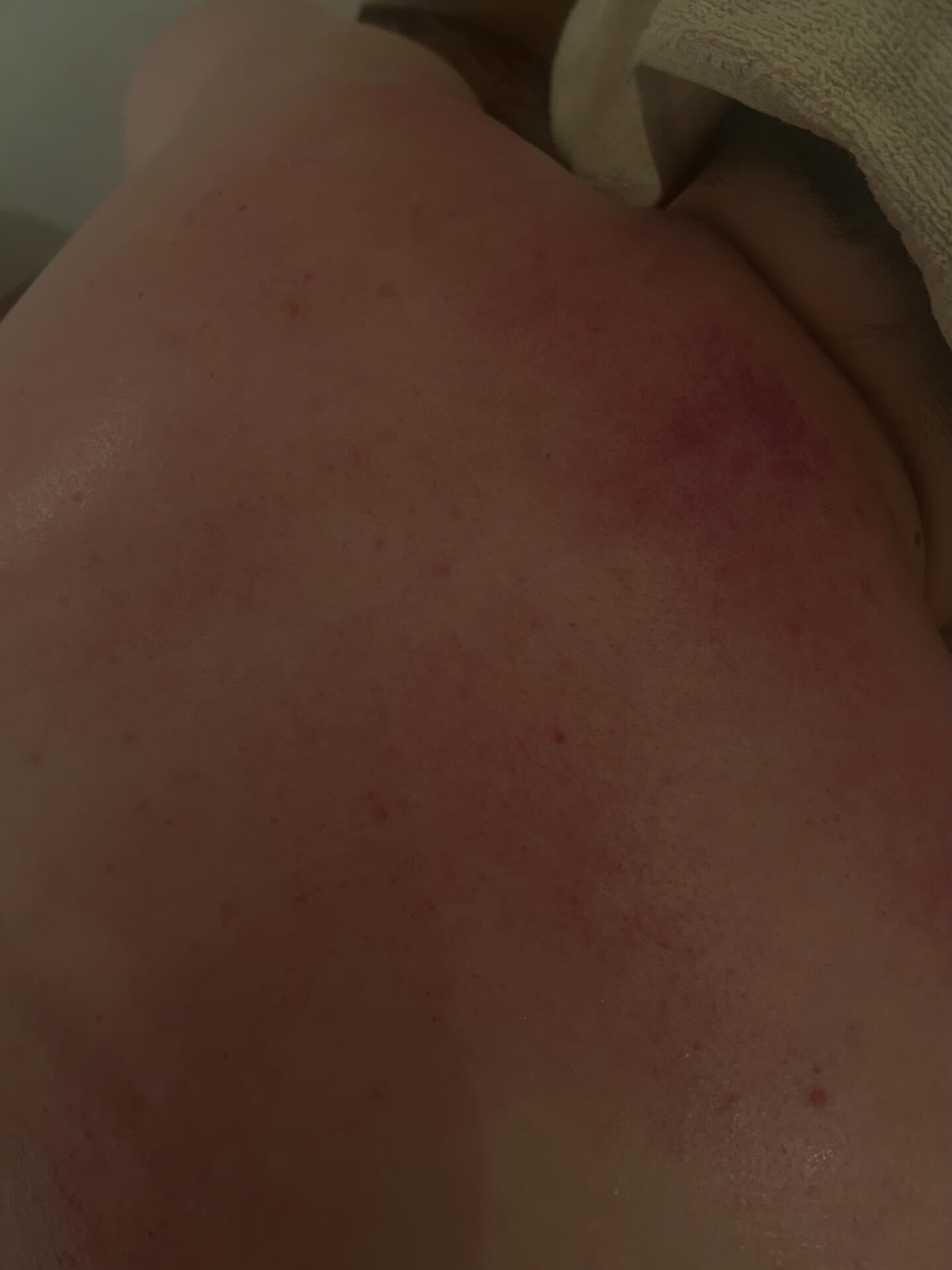肩凝りで悩んでる方多いです、、