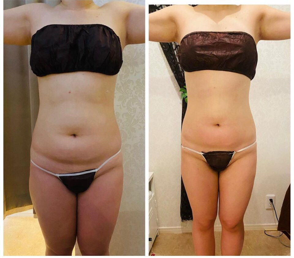 お腹痩せ、最も簡単で効果的な方法をご存知ですか？