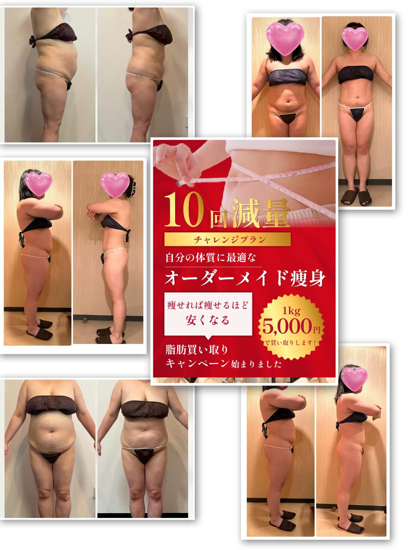 30代からの本気痩身