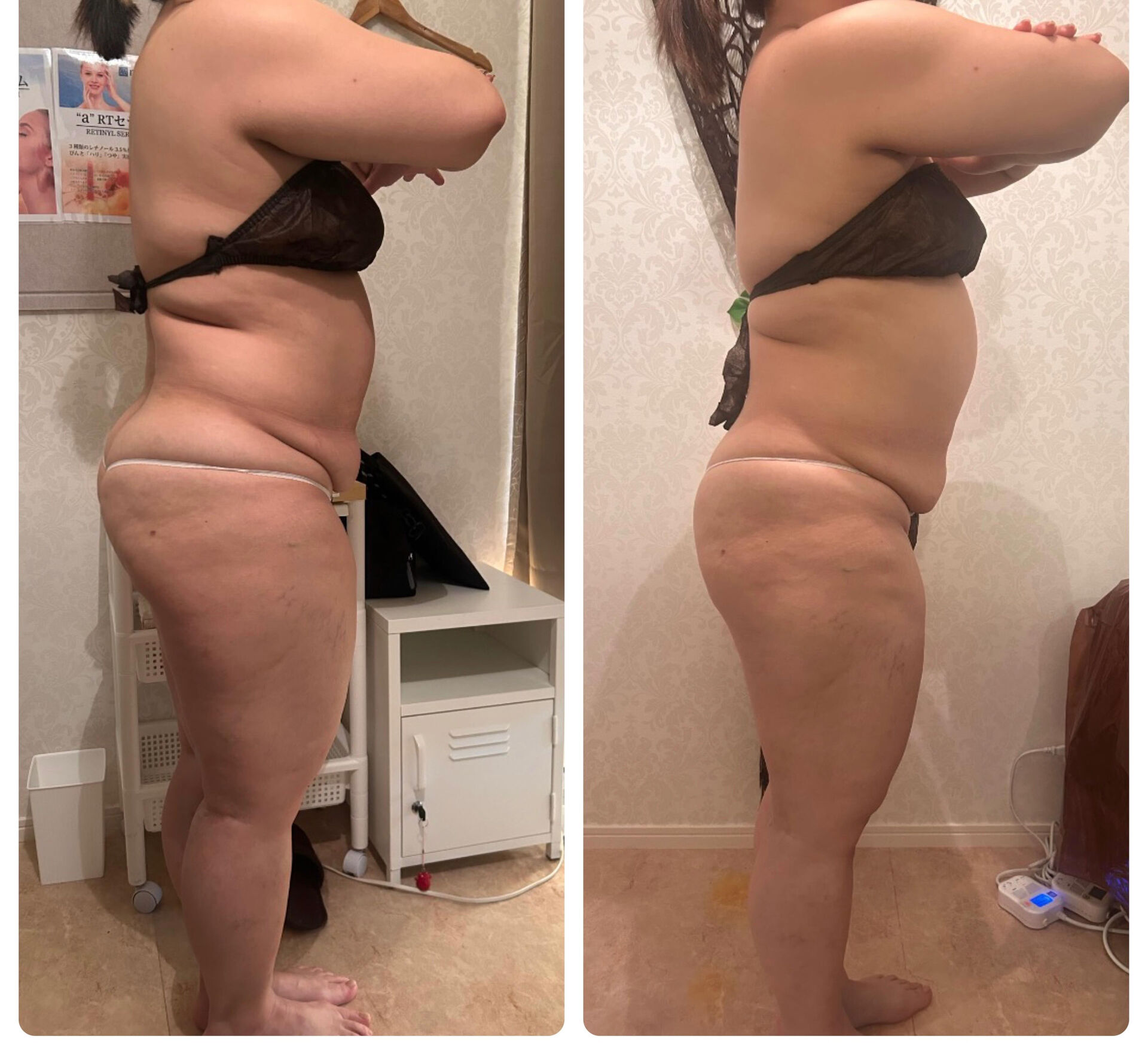【46歳・−6kg達成】お腹だけが痩せない…そんなお悩みあり